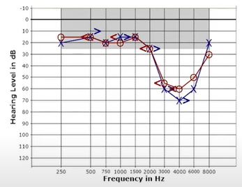 EarTalk July 2021 - Understanding hearing loss